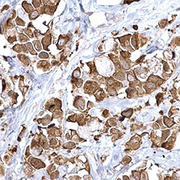 Fatty Acid Synthase antibody